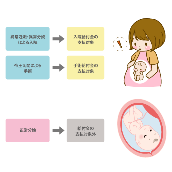 異常分娩の保険金支払い対象