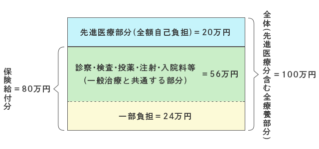 先進医療にかかる費用は全額負担